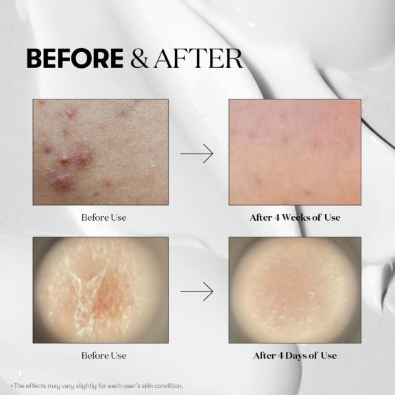 VT Cosmetics Reedle Shot 300 Stick Pouch - megújító mikrotűs kezelés 10 darabos utazó kiszerelés