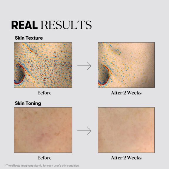 VT Cosmetics Tx-Toning Daily Mask 30 db - Folthalványító és bőrkiegyenlítő napi fátyolmasz