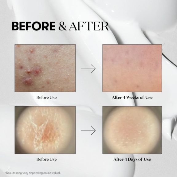 VT Cosmetics Mild Reedle Shot 50 - mikrotűs szérum